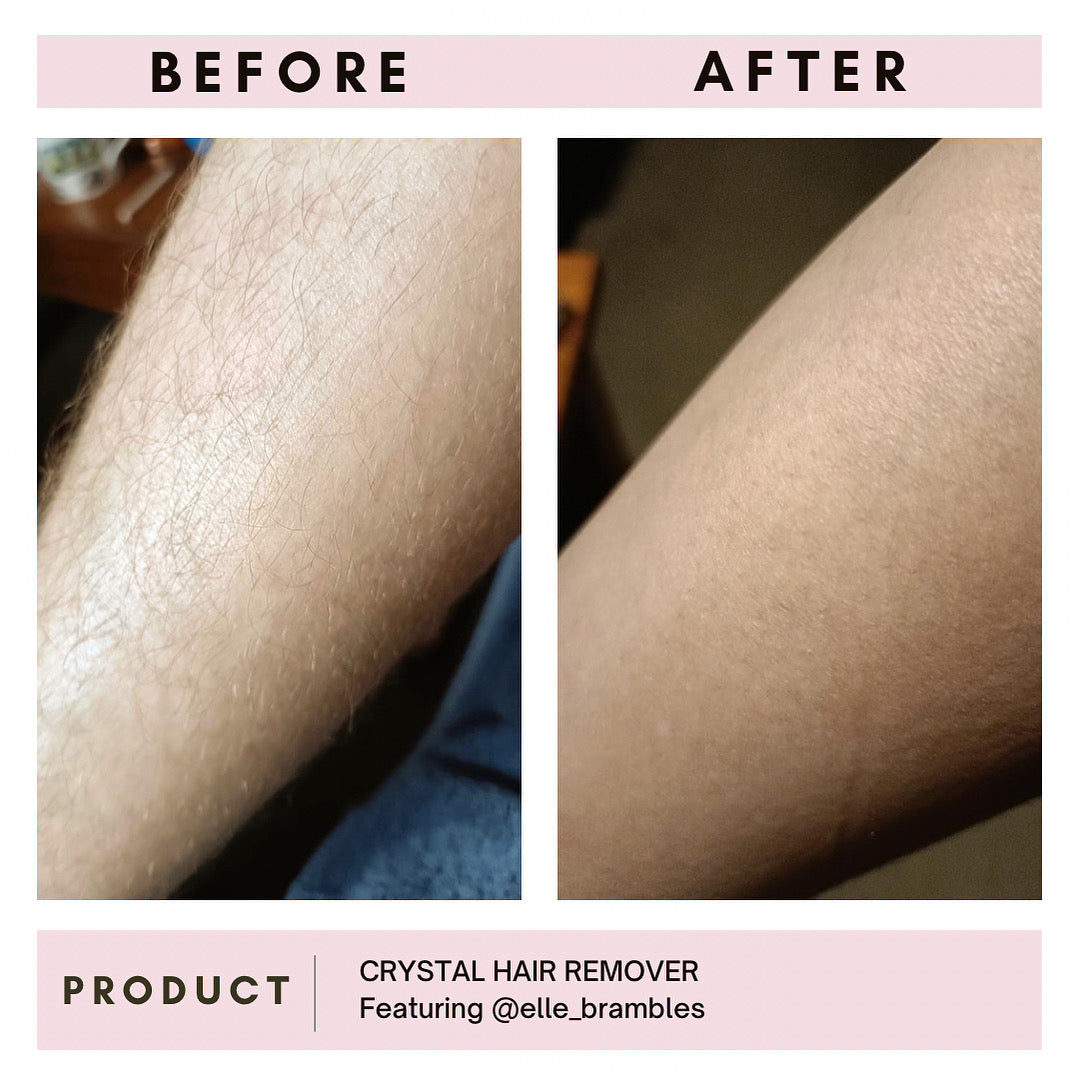 Crystal Hair Remover