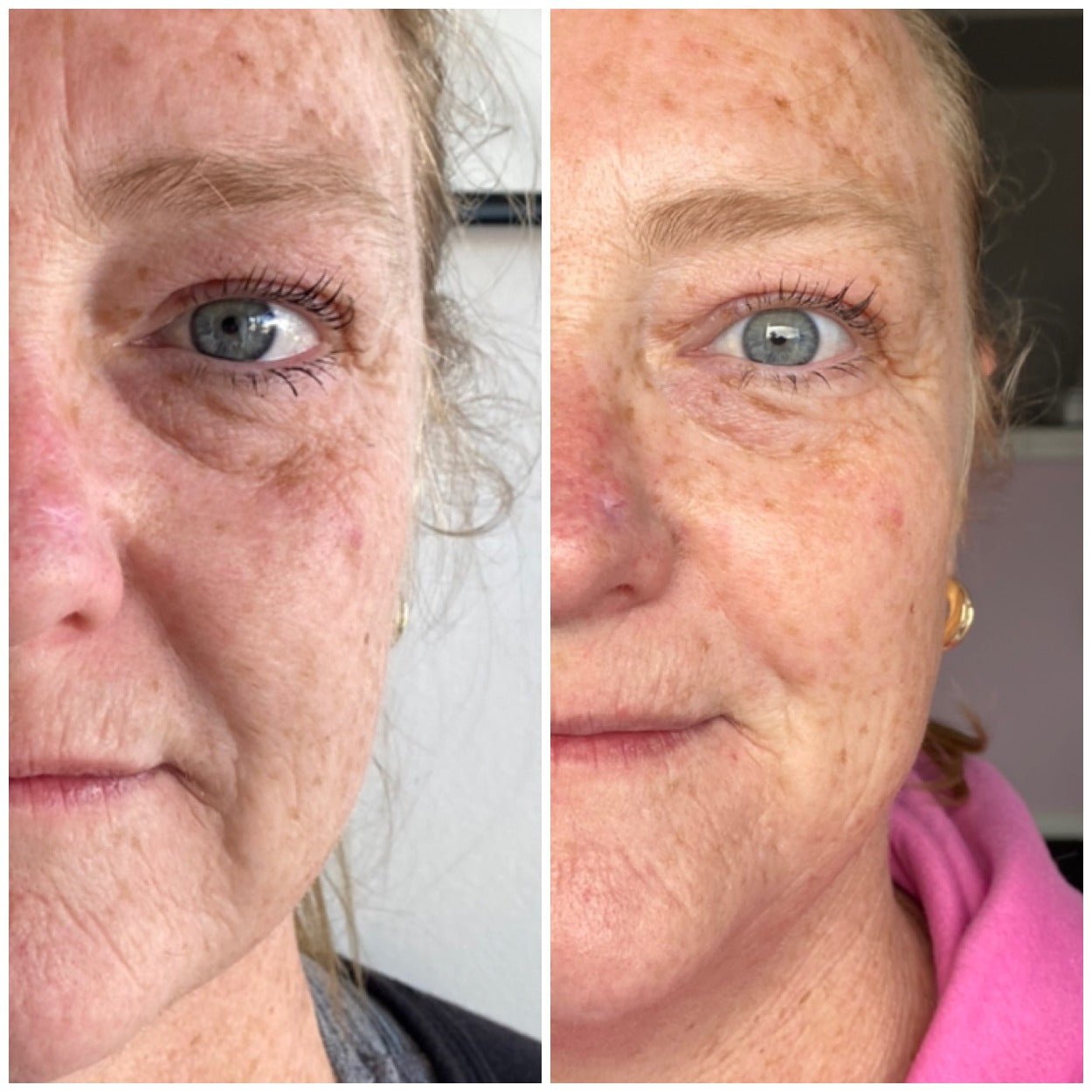 2-In-1 Face And Eye Cream Face Cream Eye Cream Sensitive Skin Sensitive Skin Care Facial Cream 